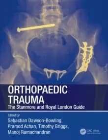 Orthopaedic Trauma : The Stanmore and Royal London Guide