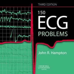 150 Ecg Problems by John R Hampton Paperback