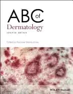 abc of dermatology