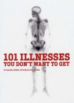 101 Illnesses You Dont Want to Get by Michael Powell Paperback