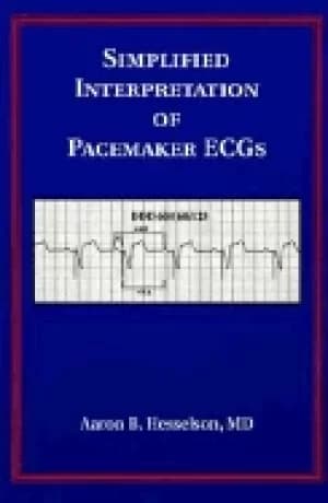 simplified interpretation of pacemaker ecgs