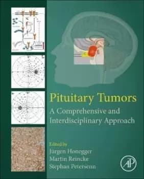 Pituitary Tumors by Jurgen Honegger