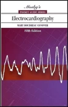 Electrocardiography by Mary Boudreau Conover