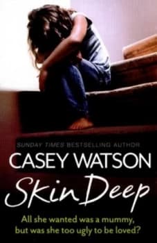 Skin Deep by Casey Watson Paperback