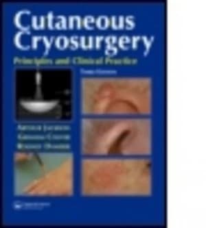 Cutaneous Cryosurgery by Graham B. Colver Hardback