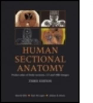 Human Sectional Anatomy by Harold Ellis Paperback