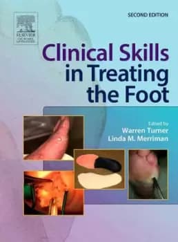 Clinical skills in treating the foot by Warren Turner