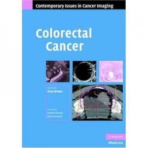 Colorectal Cancer by Gina Brown Hardback