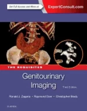 genitourinary imaging the requisites the requisites