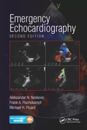 Emergency Echocardiography
