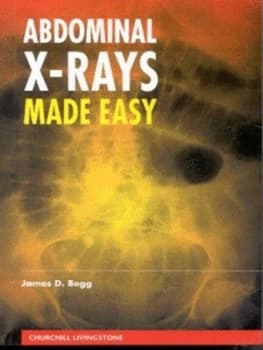 Abdominal X-Rays Made Easy by James D Begg Paperback