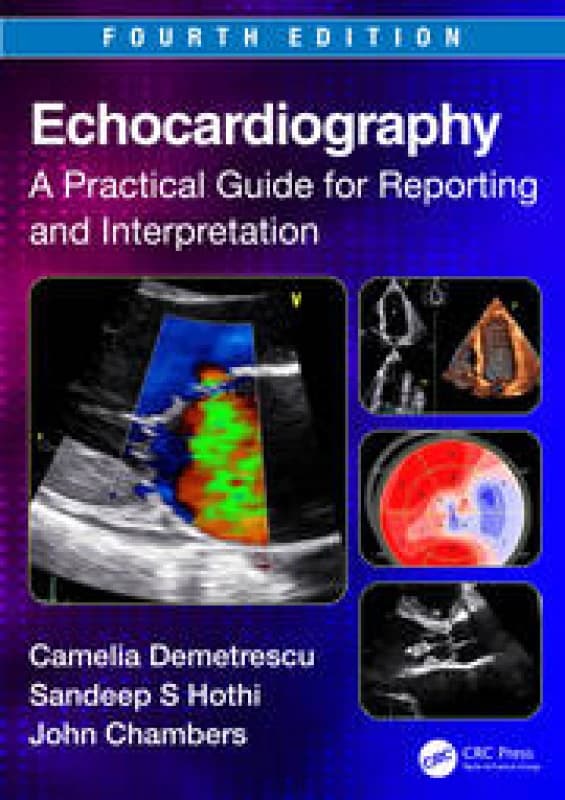 Echocardiography : A Practical Guide for Reporting and Interpretation Paperback / softback