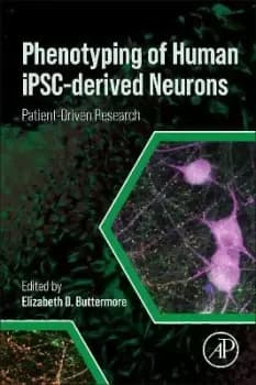 Phenotyping of Human iPSC-derived Neurons by Elizabeth D. Buttermore