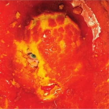 Wackelkontakt - Heal The Split Vinyl