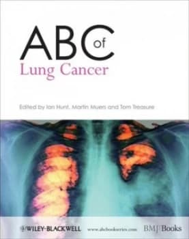 Abc of Lung Cancer by Ian Hunt Paperback